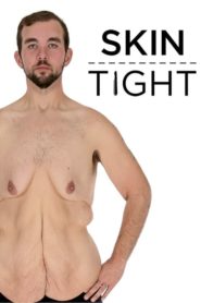 My 600-lb Life: Skin Tight